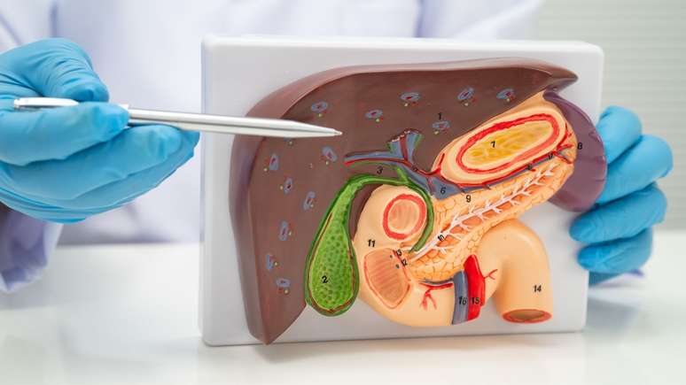 சாப்பிட்ட பிறகு வயிற்று வலி பித்தப்பைக் கற்களைக் குறிக்கலாம்; அறிகுறிகள், அபாயங்கள் மற்றும் அறுவை சிகிச்சை சுட்டிக்காட்டப்படும் போது புரிந்து கொள்ளுங்கள்