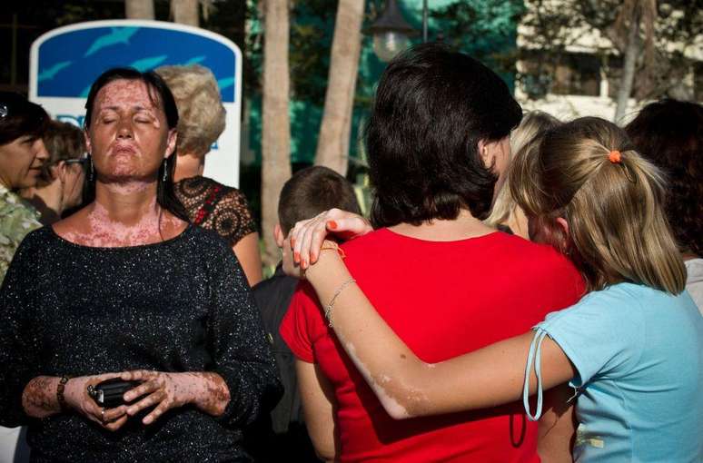 Adultos tamb&eacute;m participaram do programa de assist&ecirc;ncia do governo cubano, embora a maioria fossem crian&ccedil;as