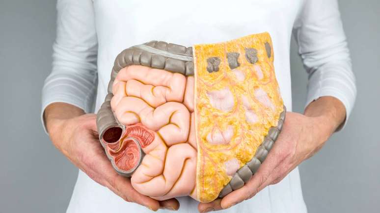 intestino &ndash; depositphotos.com/benschonewille