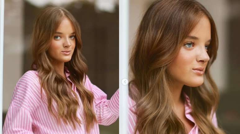 Rafaella Justus புதிய ரைனோபிளாஸ்டியின் முடிவுகளைக் காட்டுகிறது