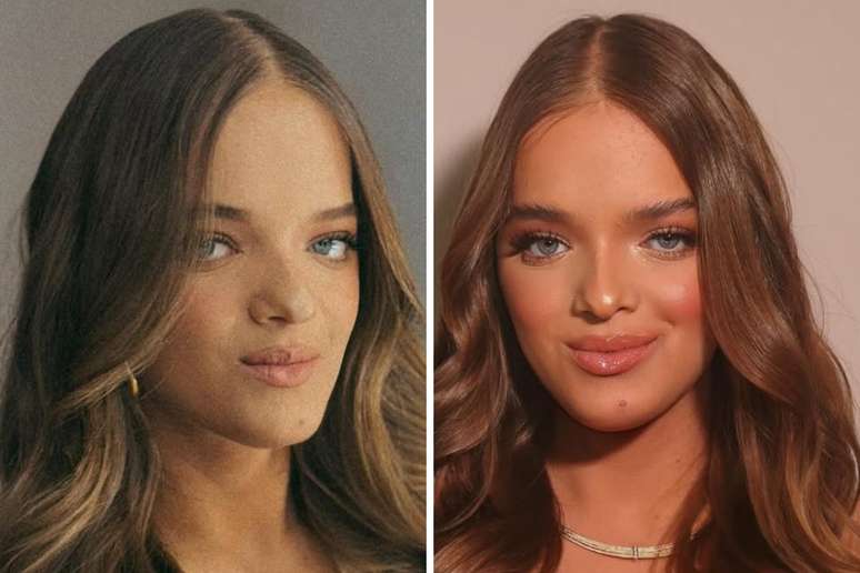 Rafa Justus antes da segunda cirurgia no nariz