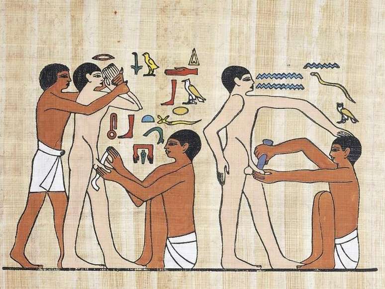 Acredita-se que a circuncis&atilde;o tenha sido realizada pela primeira vez no Egito