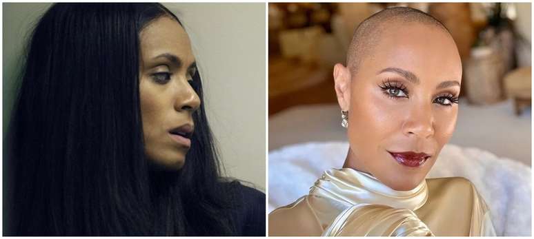 A atriz norte-americana Jada Pinkett Smith preferiu raspar a cabe&ccedil;a ap&oacute;s anos de luta contra a alopecia