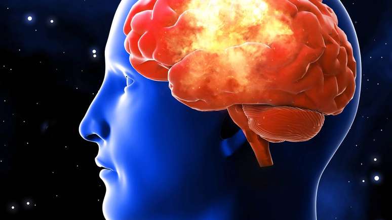 cerebral -depositphotos.com / 100502500