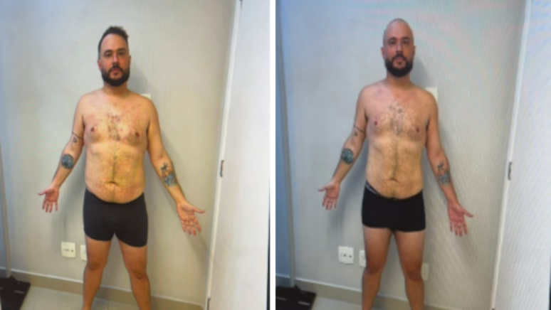 Ed Gama mostra resultados de antes e depois