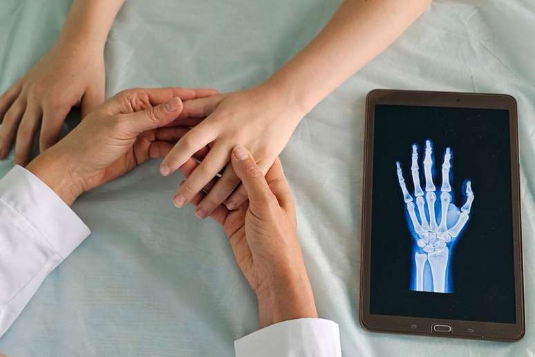 Radiografia do punho auxilia no acompanhamento do crescimento da crian&ccedil;a 