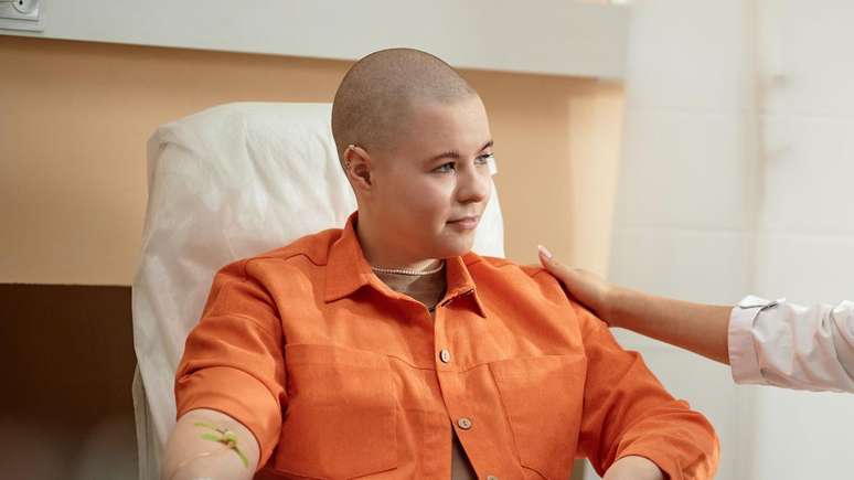 Mulher jovem careca