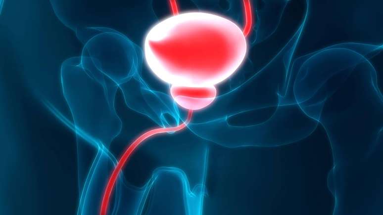 quando encontra-se o tumor antes que ele se espalhe para outros &oacute;rg&atilde;os, as taxas de sobrevida em cinco anos se aproximam de 100% em muitos estudos internacionais &ndash; depositphotos.com / magicmine