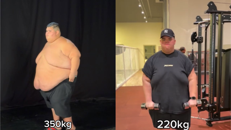 Gord&atilde;o da XJ mostra antes e depois de perder 130 kg