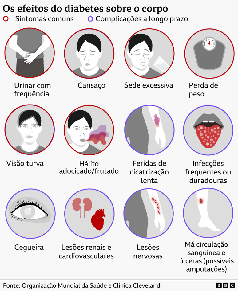 Gr&aacute;fico mostrando os efeitos do diabetes sobre o corpo humano. Seus sintomas comuns incluem urinar com frequ&ecirc;ncia, cansa&ccedil;o, sede excessiva, perda de peso, vis&atilde;o turva e h&aacute;lito adocicado/frutado. Os sintomas de longo prazo incluem feridas que cicatrizam lentamente, infec&ccedil;&otilde;es frequentes ou duradouras, cegueira, les&otilde;es renais e cardiovasculares, les&otilde;es nervosas, m&aacute; circula&ccedil;&atilde;o sangu&iacute;nea e &uacute;lceras, que podem causar amputa&ccedil;&otilde;es.