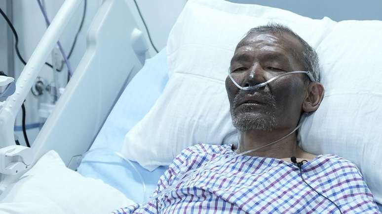 Dawa Sherpa ainda recebe tratamento em um hospital em Katmandu, capital do Nepal
