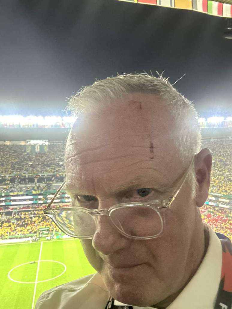 Ex-lateral ingl&ecirc;s trabalhava como comentarista da Fox quando foi atingido na tribuna do Est&aacute;dio Azteca &ndash;