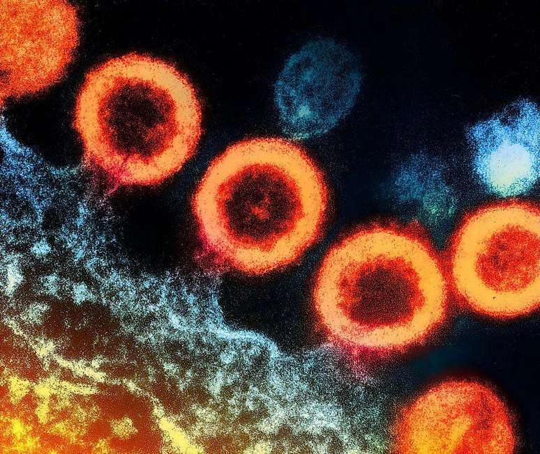 O HIV ataca as c&eacute;lulas do sistema imunol&oacute;gico, dificultando o combate natural do v&iacute;rus pelos pacientes, mas os controladores de elite possuem sistemas imunol&oacute;gicos adaptados para essa luta