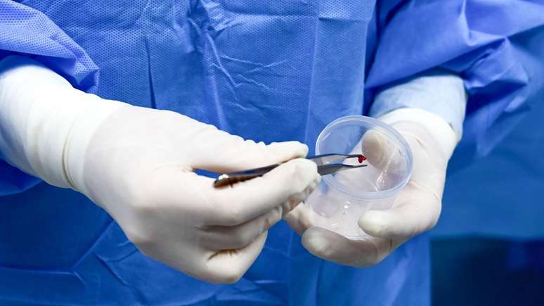 A doen&ccedil;a de Cushing costuma demorar dois anos para ser diagnosticada, de acordo com estimativas internacionais