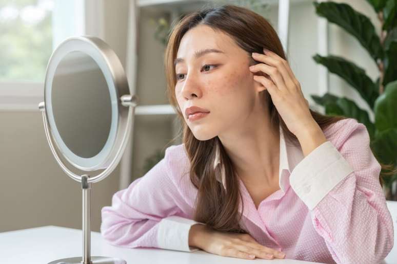 Condi&ccedil;&otilde;es como melasma e ros&aacute;cea exigem abordagens mais suaves 
