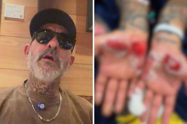 Henrique Foga&ccedil;a relata acidente de moto e roubo de alian&ccedil;a