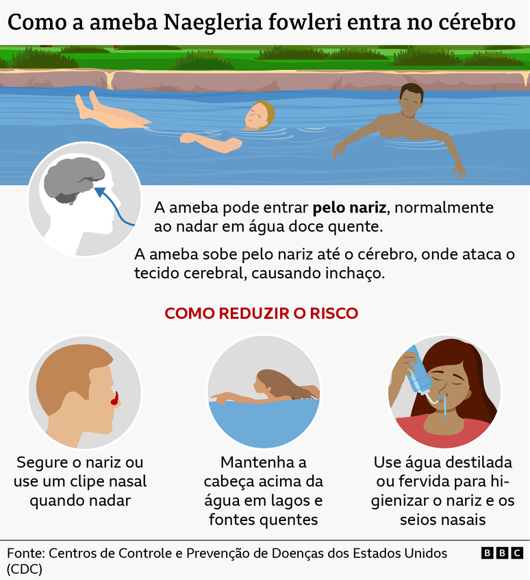 Gr&aacute;fico mostrando as rotas de entrada da "ameba comedora de c&eacute;rebros" e como evitar a infec&ccedil;&atilde;o