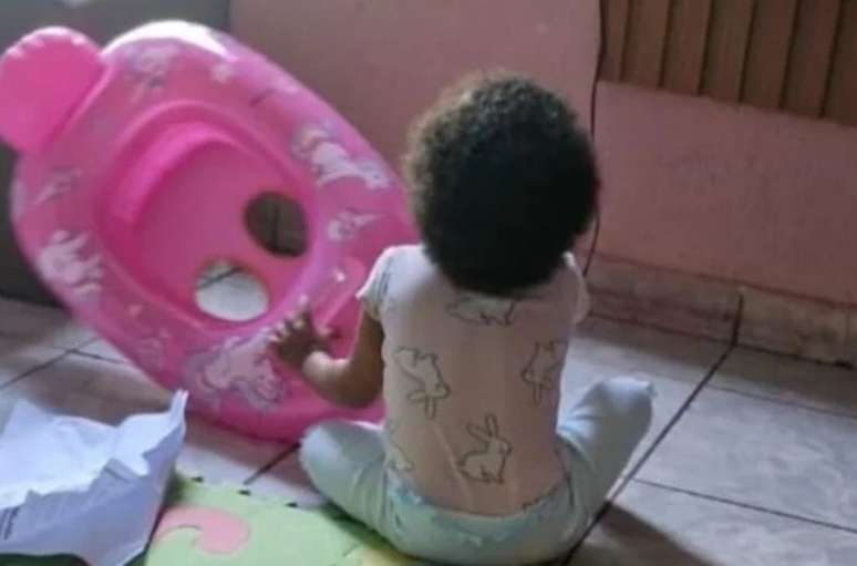 Zoe tem 1 ano e 11 meses e espera por cirurgia urgente