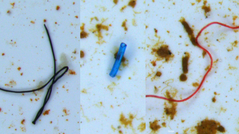 Imagens de microsc&oacute;pio mostram os micropl&aacute;sticos no organismo dos girinos