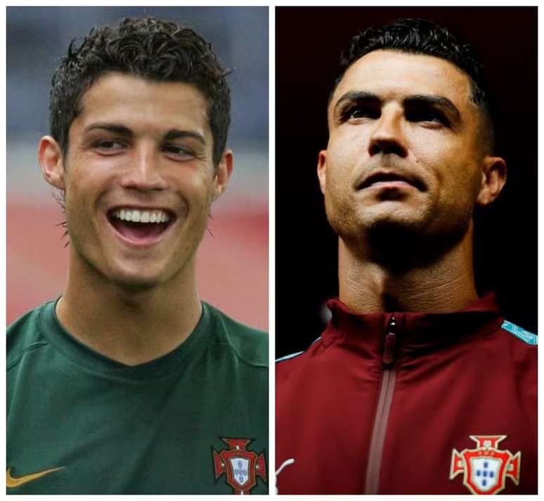 Cristiano Ronaldo antes e depois da harmoniza&ccedil;&atilde;o facial (Fotos: Reprodu&ccedil;&atilde;o/ge/Redes sociais)