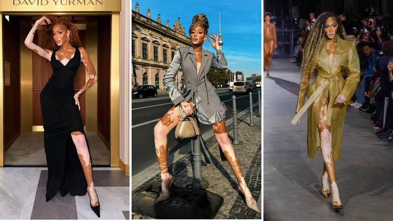 Winnie Harlow 