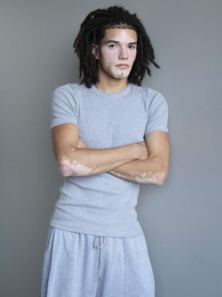 Vitor Santos 