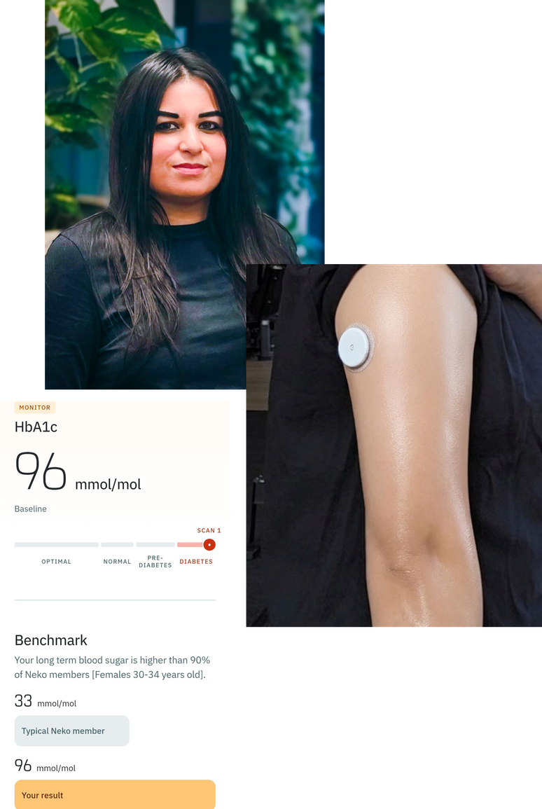 Os n&iacute;veis de a&ccedil;&uacute;car no sangue de Mehvish a longo prazo estavam muito elevados e ela foi diagnosticada com diabetes autoimune latente.