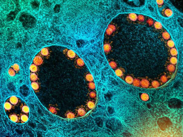 Imagem microsc&oacute;pica de part&iacute;culas do v&iacute;rus SARS-CoV-2 revestindo algumas ves&iacute;culas em uma c&eacute;lula