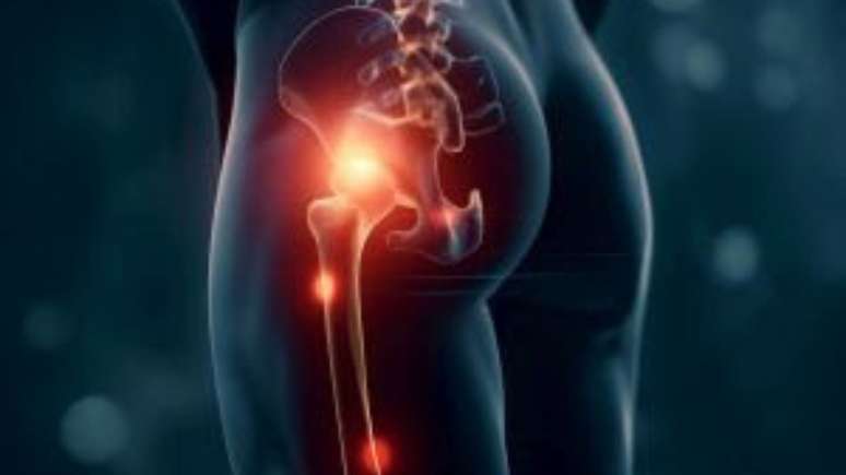 O nervo ci&aacute;tico se destaca como o maior nervo do corpo humano e percorre toda a regi&atilde;o posterior da perna