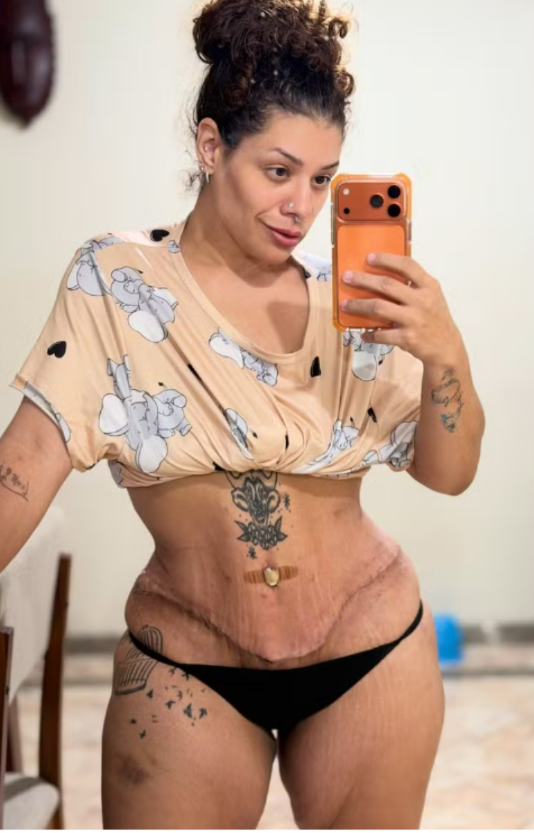 Aila Menezes viveu um relacionamento abusivo, enfrentou a obesidade e passou por cirurgia ap&oacute;s o emagrecimento provocado pela bari&aacute;trica