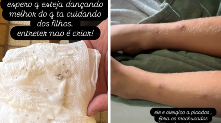Luana mostra piolhos em Liz e machucados de Bem