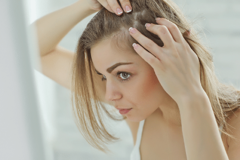 Geralmente, ap&oacute;s o efl&uacute;vio tel&oacute;geno, o cabelo volta a crescer normalmente 