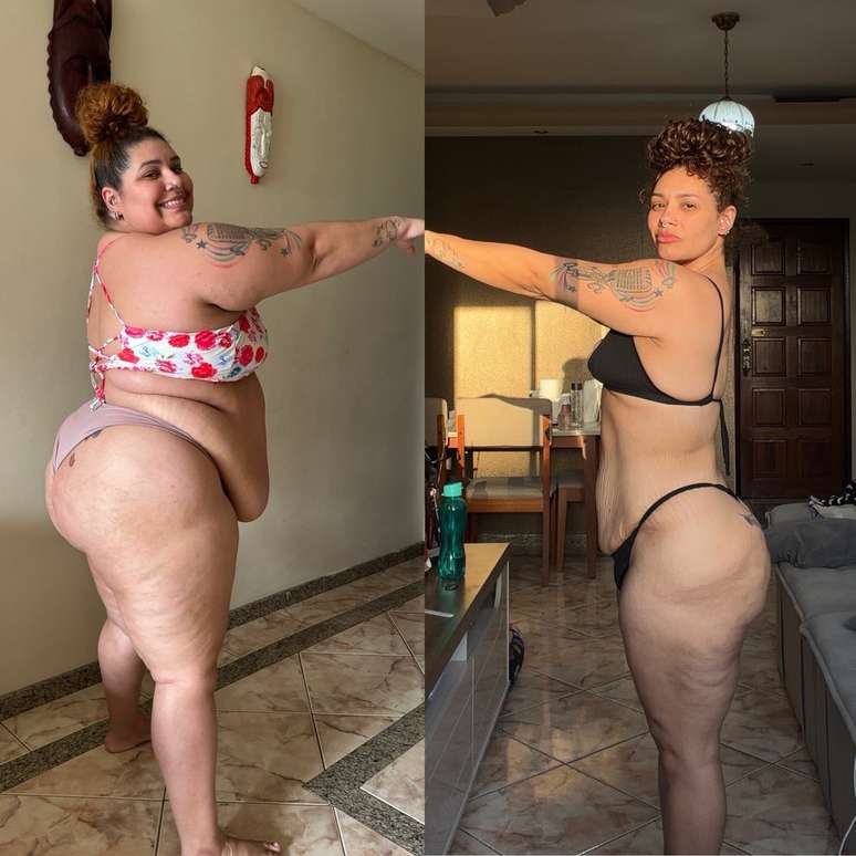 Aila Menezes mostra antes e depois de bari&aacute;trica &mdash;