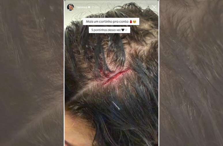 Defensora brincou nas redes sociais ap&oacute;s receber cinco pontos &ndash;
