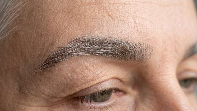 A aplica&ccedil;&atilde;o caseira pr&oacute;xima aos olhos envolve riscos de irrita&ccedil;&otilde;es severas e dermatite.