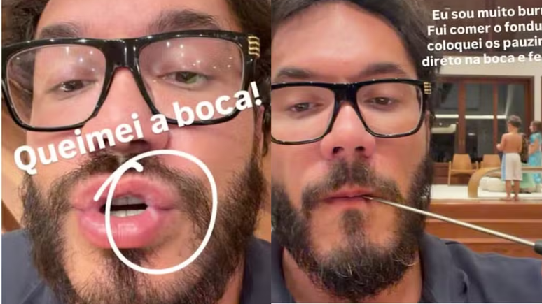 Eliezer sofre acidente dom&eacute;stico
