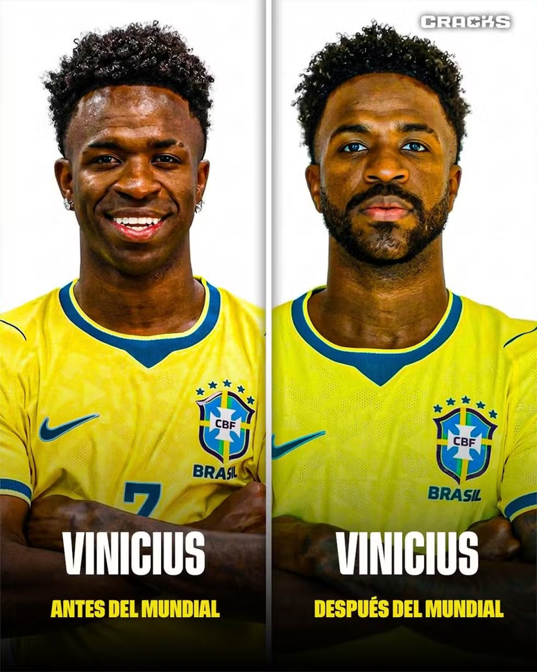 Vini Jr fez harmoniza&ccedil;&atilde;o facial e atualizou sua foto oficial da CBF