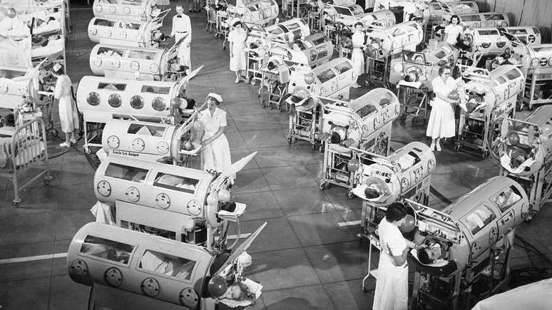 Nas d&eacute;cadas de 1940 e 1950, enfermarias inteiras eram ocupadas por pulm&otilde;es de a&ccedil;o para cuidar de pacientes com poliomielite, como esta no Hospital do Condado de Los Angeles