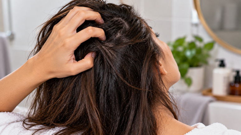 Trocar de shampoo nem sempre resolve a coceira no couro cabeludo. Veja como o enx&aacute;gue inadequado pode irritar a pele e quais sinais observar.