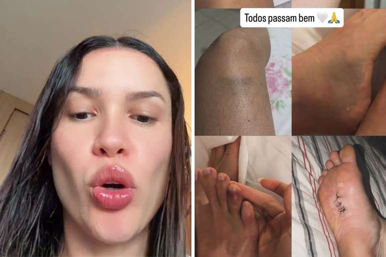 Juliette fala sobre despedida de solteira | Juliette mostra machucados dos amigos