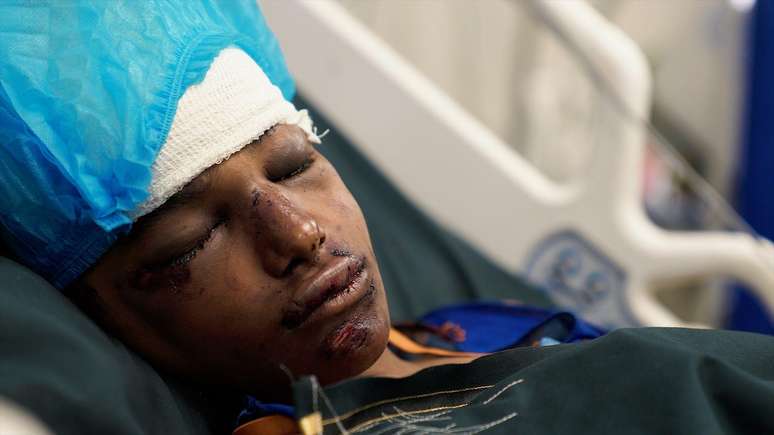 Ghana, de doze anos, ficou gravemente ferida por um morteiro enquanto pastoreava cabras.