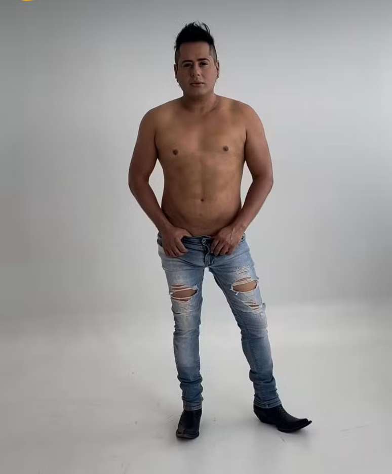Hugo compartilhou resultados ap&oacute;s a lipoaspira&ccedil;&atilde;o