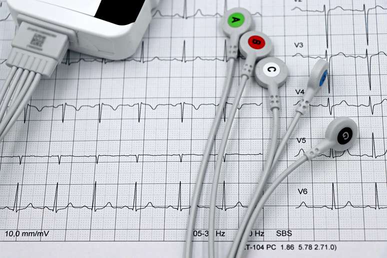 Exame cardiol&oacute;gico
