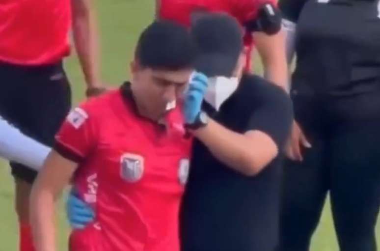 Lenin Ojeda sofreu uma fratura na face com o impacto da pedrada &ndash;