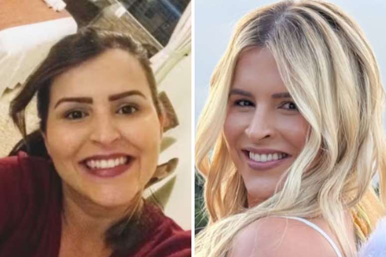 Aline Limas antes e depois dos procedimentos est&eacute;ticos