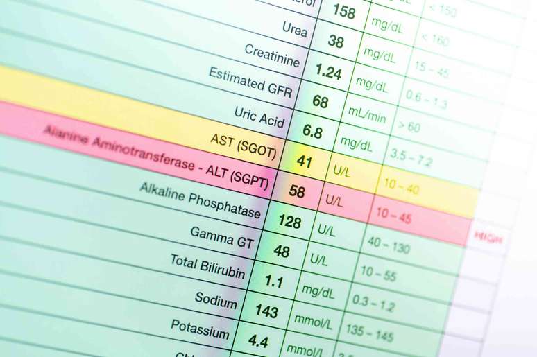 Tabela de resultados de exames laboratoriais com AST e ALT apresentando n&iacute;veis anormais