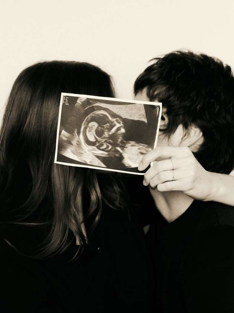 Casal compartilhou uma imagem do ultrassom ao anunciar gravidez