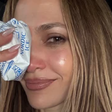 Jennifer Lopez sofre acidente em ensaio de premiação e leva pontos no rosto