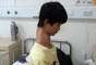 O chin&ecirc;s Fu Wengui, 15 anos, possui dez v&eacute;rtebras em seu pesco&ccedil;o, tr&ecirc;s a mais que uma pessoa comum. Diagnosticado com escoliose cong&ecirc;nita, o jovem sente dores, tem dificuldade para se locomover e sofre preconceito quando sai na rua.&nbsp;