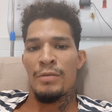 Morador de Fernando de Noronha que foi baleado por delegado tem perna amputada